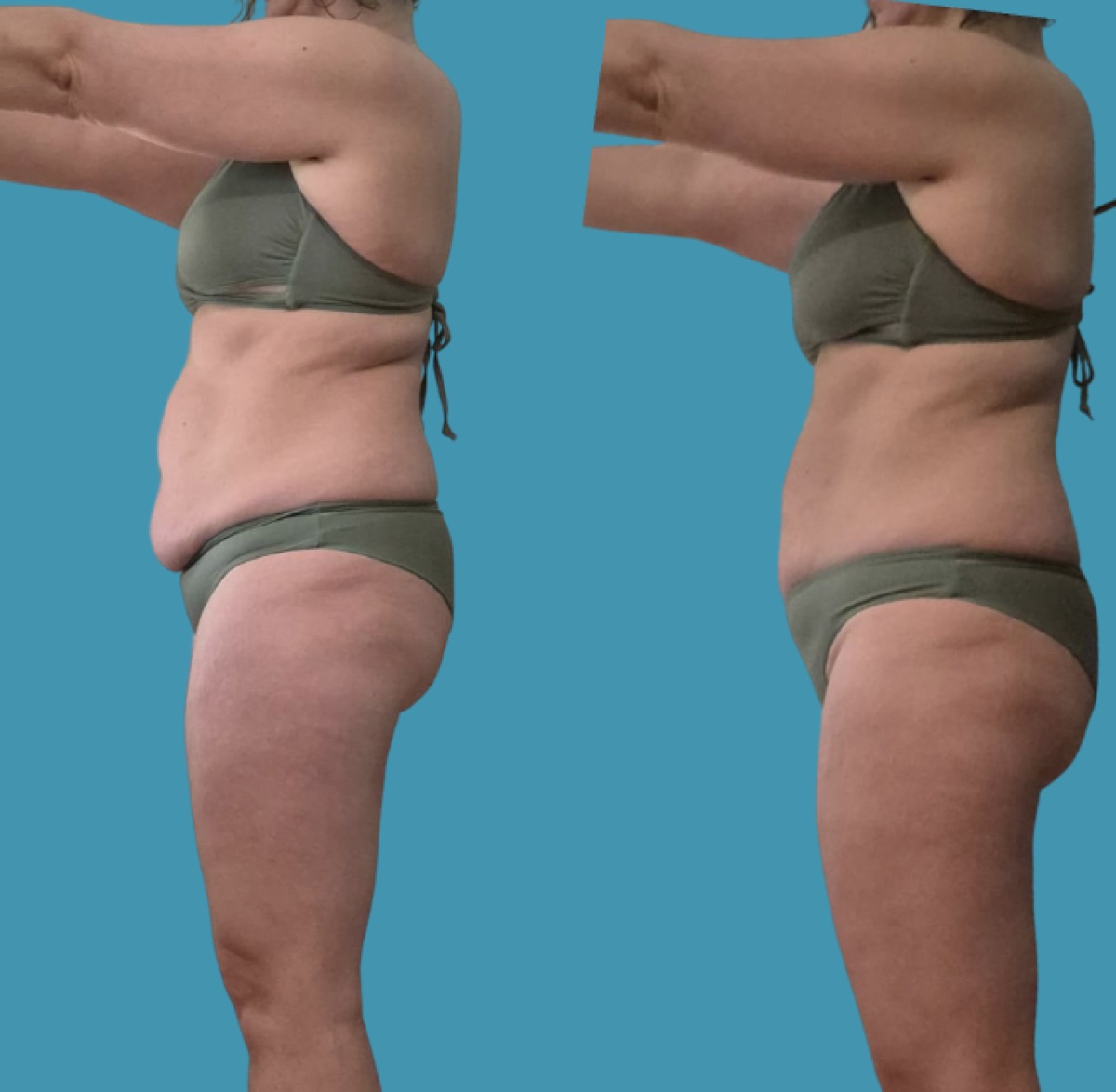 Transformation d'une cliente Diet4VIP (avant / après)