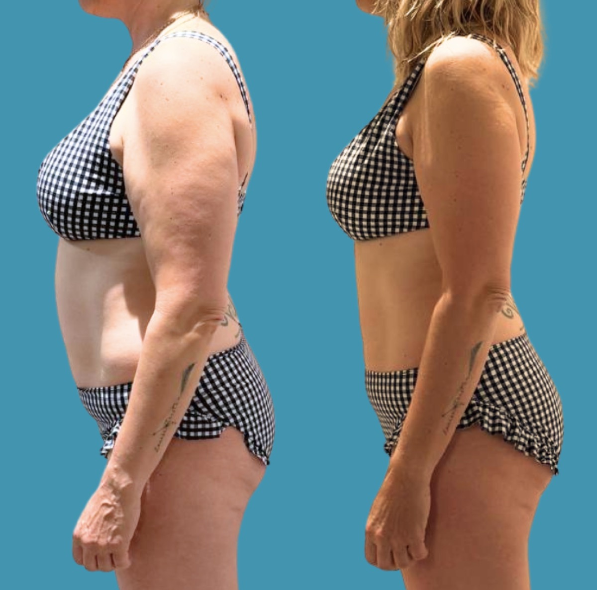 Transformation d'une cliente Diet4VIP (avant / après)